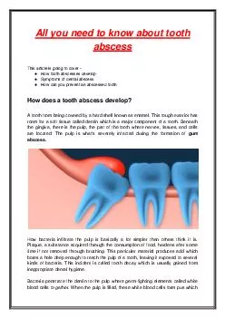 All you need to know about tooth abscess