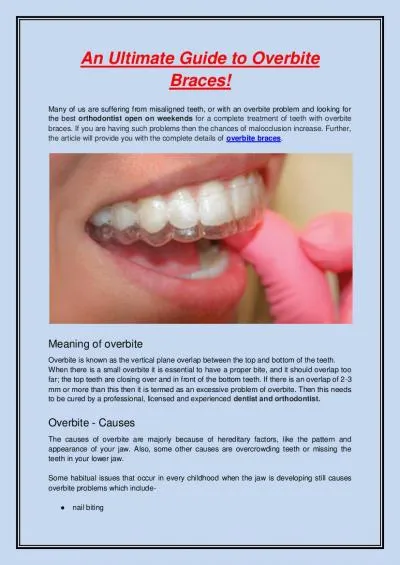 An Ultimate Guide to Overbite Braces!