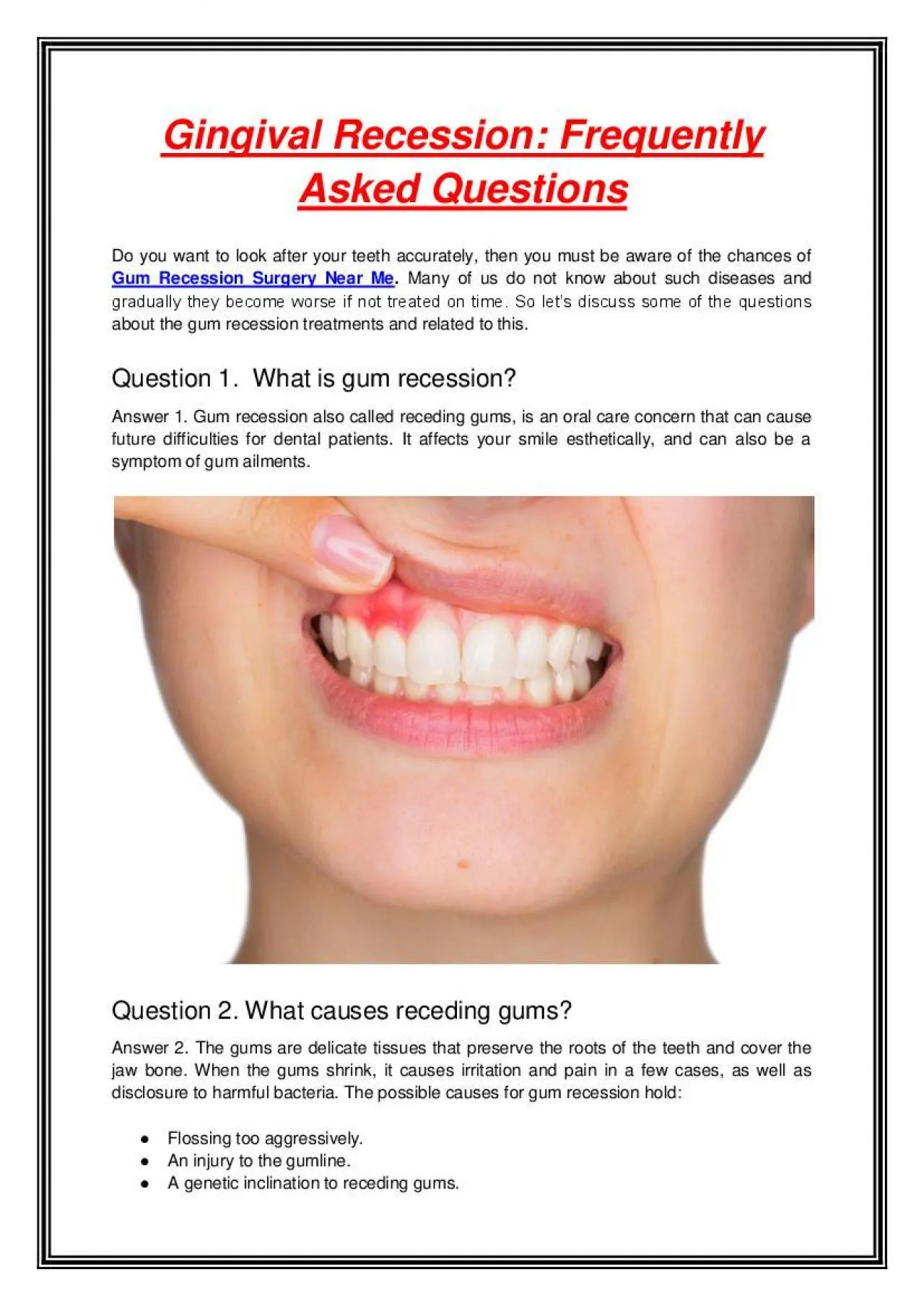 PDF-Gingival Recession: Frequently Asked Questions