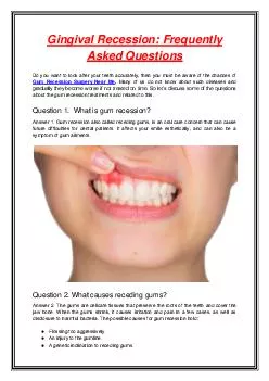 Gingival Recession: Frequently Asked Questions