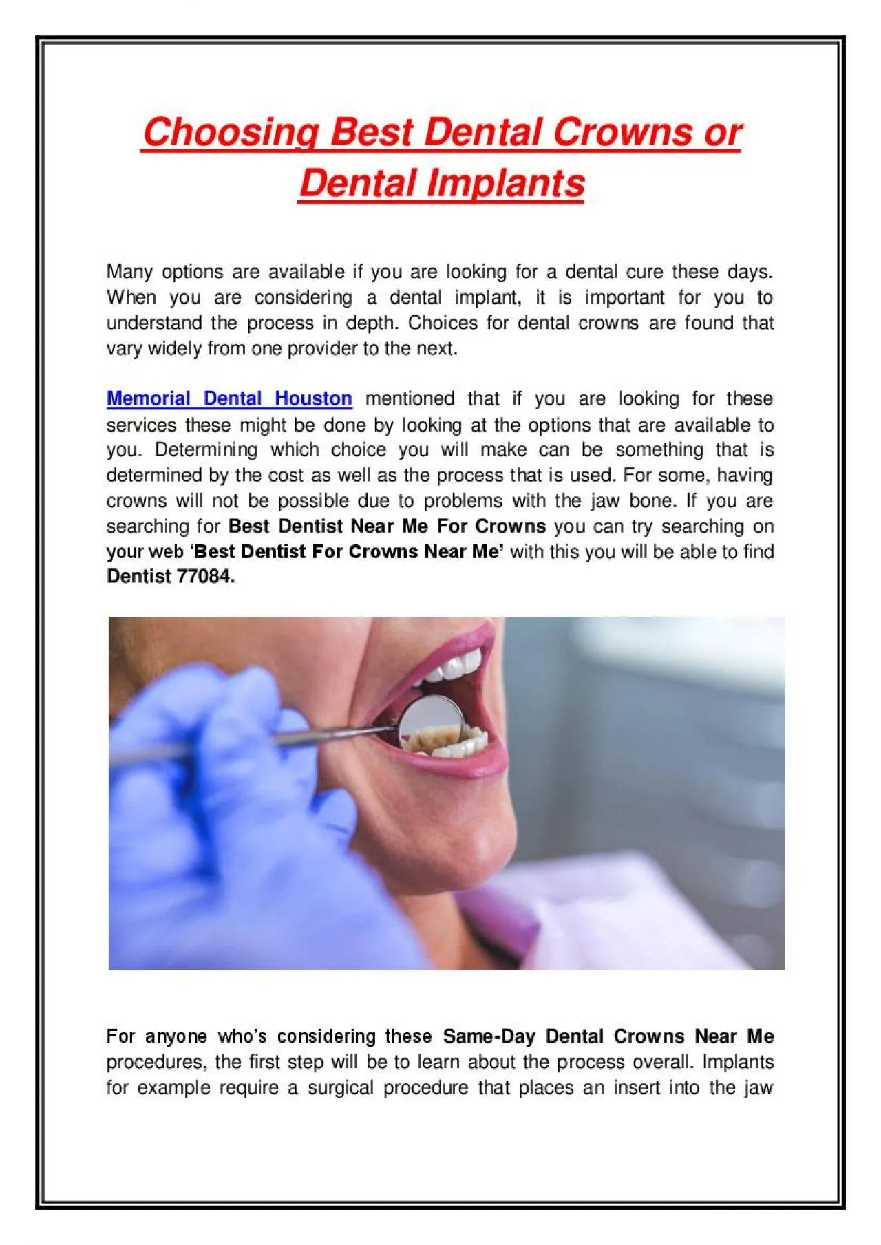 PDF-Choosing Best Dental Crowns or Dental Implants