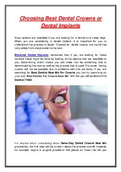 Choosing Best Dental Crowns or Dental Implants
