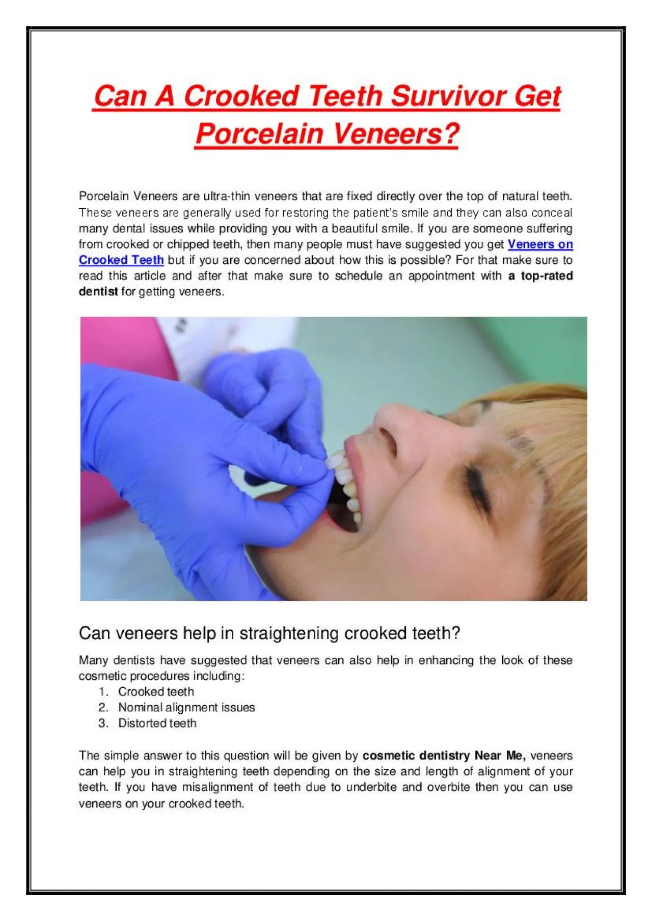 PDF-Can A Crooked Teeth Survivor Get Porcelain Veneers?