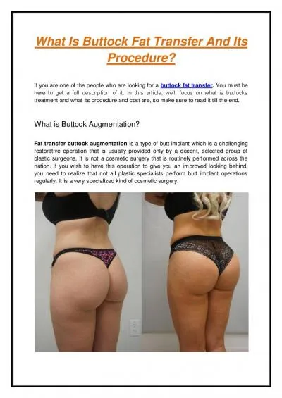 What Is Buttock Fat Transfer And Its Procedure?