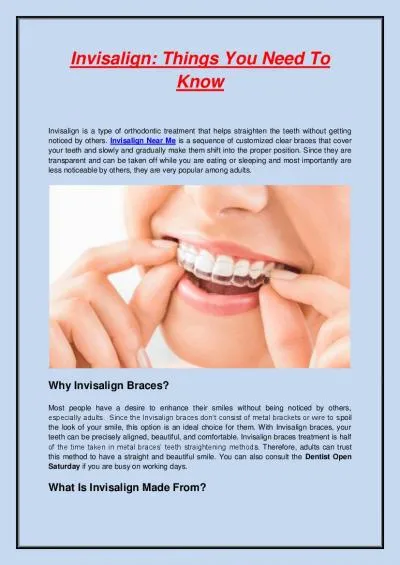 Invisalign: Things You Need To Know.