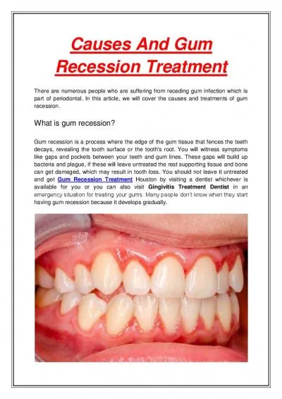 Causes And Gum Recession Treatment