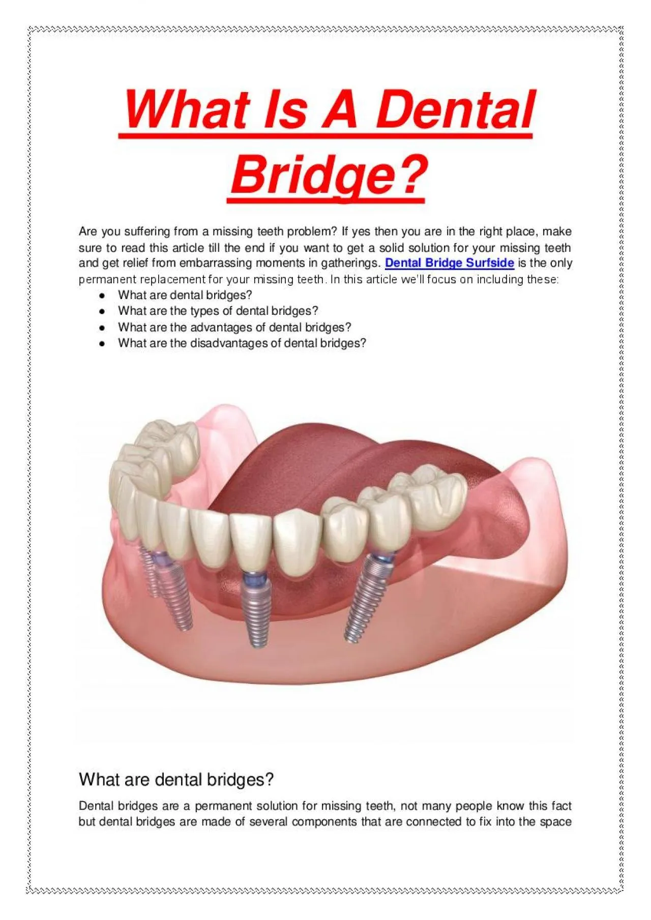 PDF-What Is A Dental Bridge?