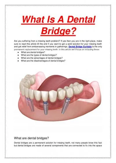 What Is A Dental Bridge?