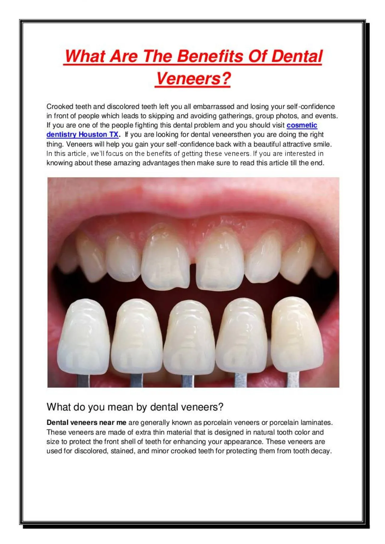 PDF-What Are The Benefits Of Dental Veneers?