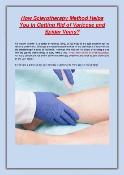 How Sclerotherapy Method Helps You In Getting Rid of Varicose and Spider Veins?