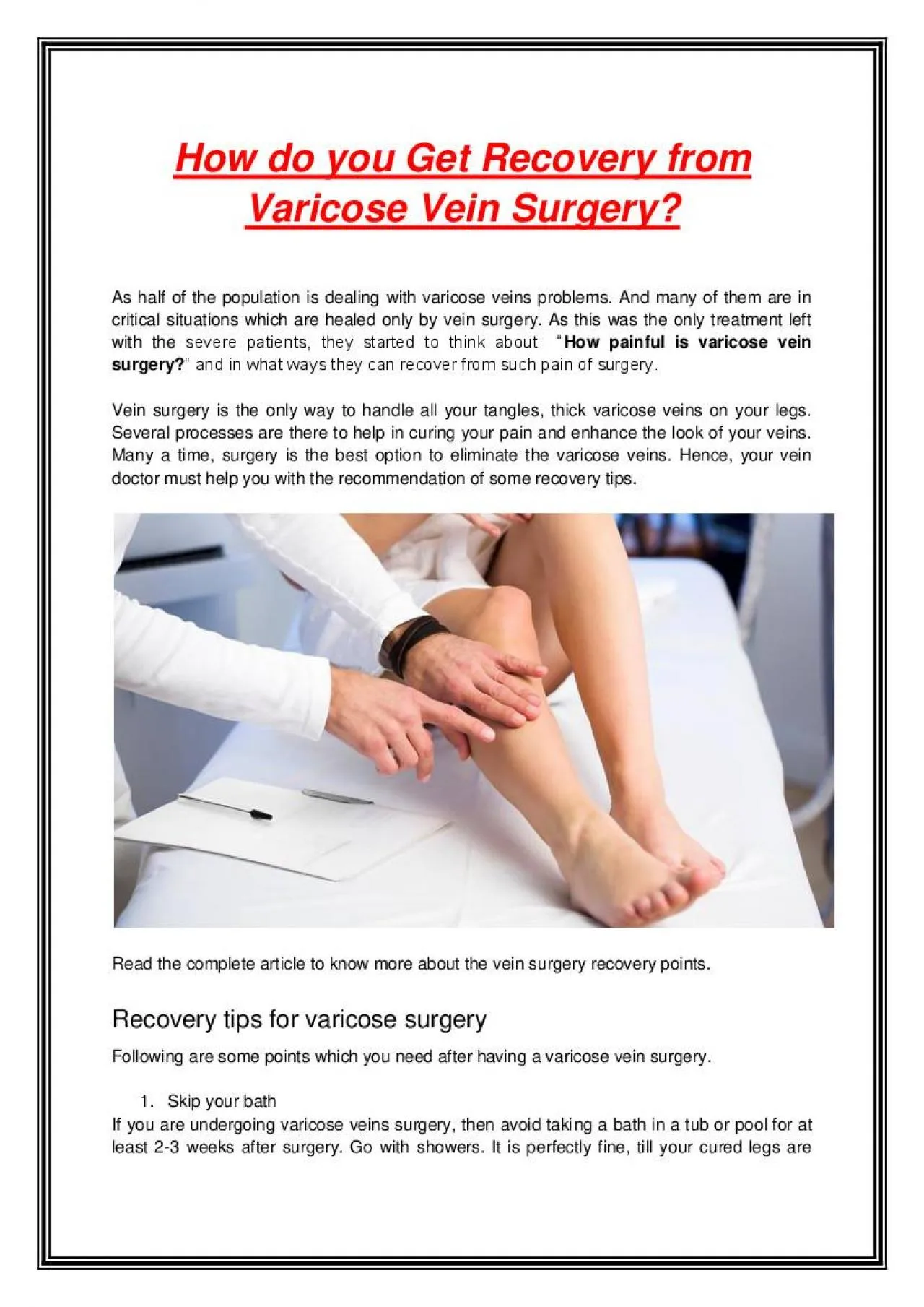 PDF-How do you Get Recovery from Varicose Vein Surgery?