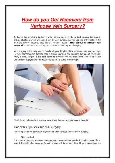 How do you Get Recovery from Varicose Vein Surgery?