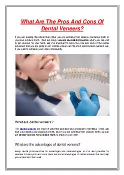 What Are The Pros And Cons Of Dental Veneers?