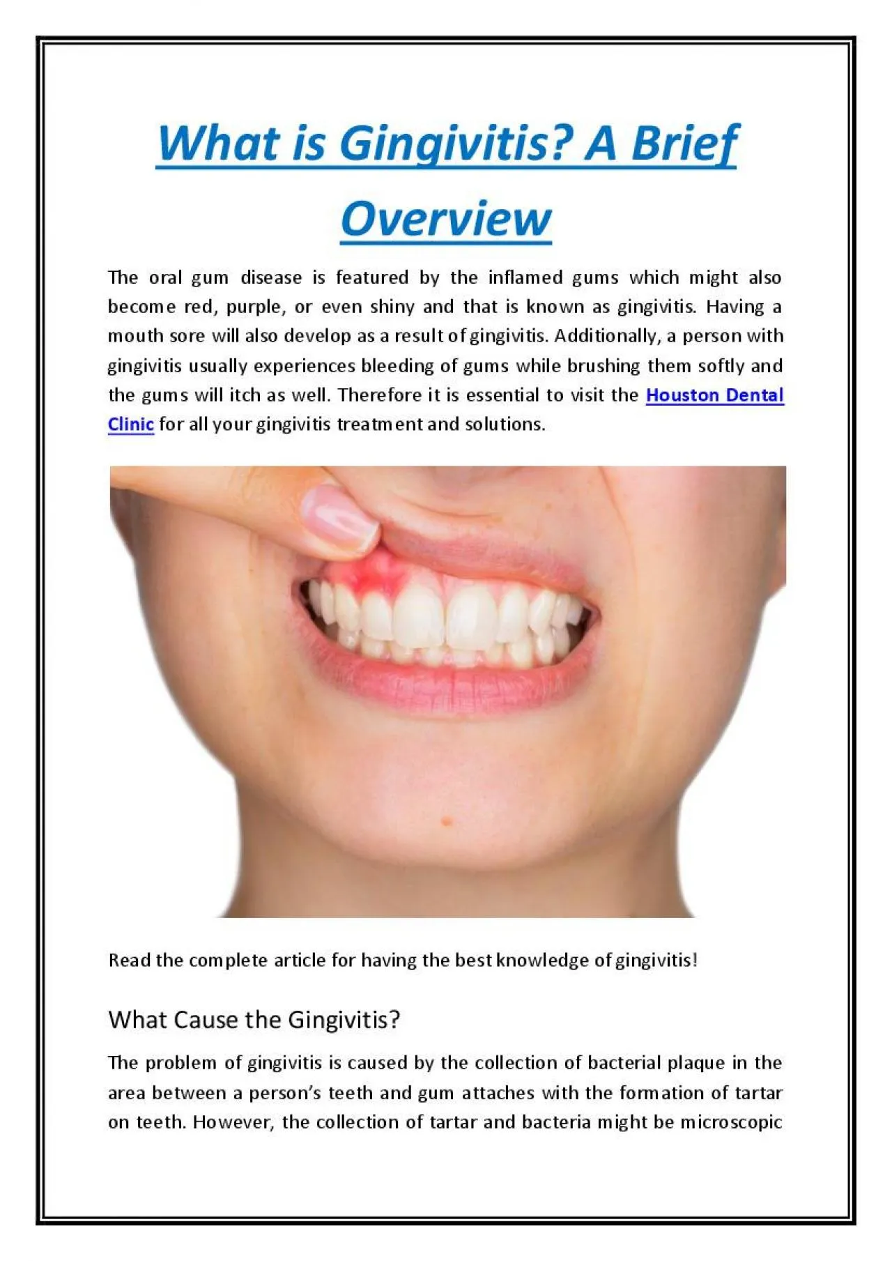 PDF-What is Gingivitis? A Brief Overview