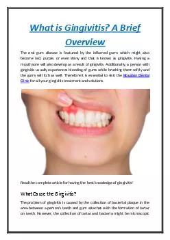 What is Gingivitis? A Brief Overview