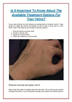 Is It Important To Know About The Available Treatment Options For Your Veins?