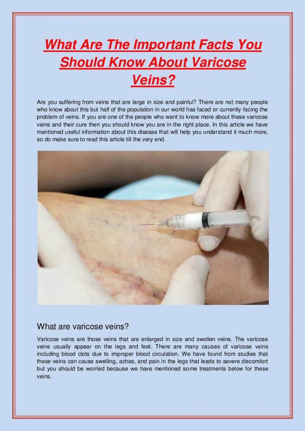 PDF-What Are The Important Facts You Should Know About Varicose Veins?