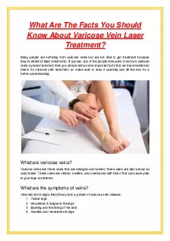 What Are The Facts You Should Know About Varicose Vein Laser Treatment?