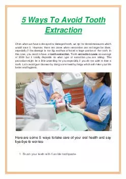 5 Ways To Avoid Tooth Extraction