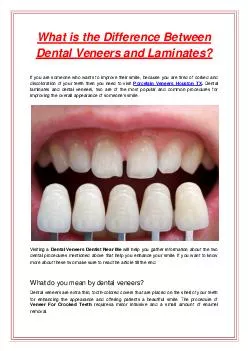 What is the Difference Between Dental Veneers and Laminates?