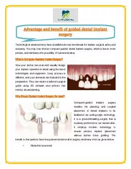 Advantage and benefit of guided dental implant surgery