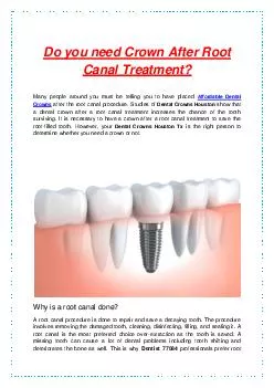 Do you need Crown After Root Canal Treatment?