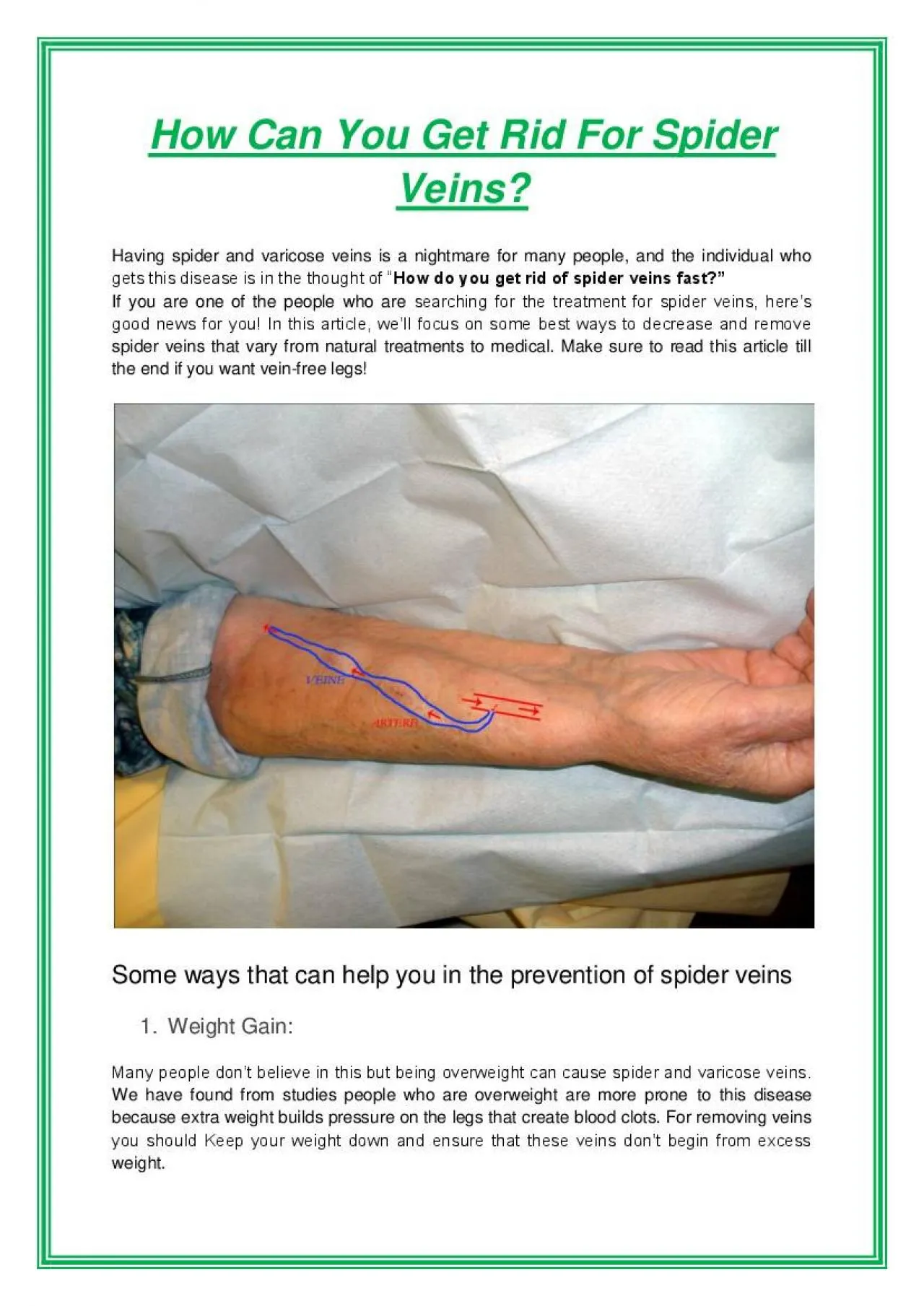 PDF-How Can You Get Rid For Spider Veins?