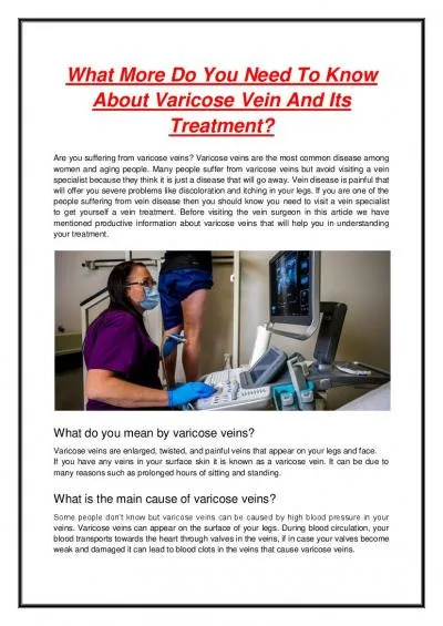 What More Do You Need To Know About Varicose Vein And Its Treatment?