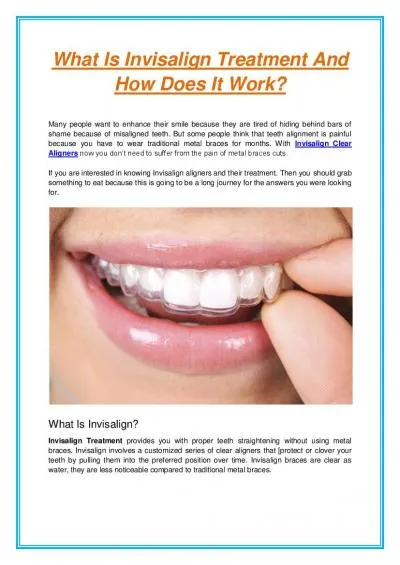 What Is Invisalign Treatment And How Does It Work?