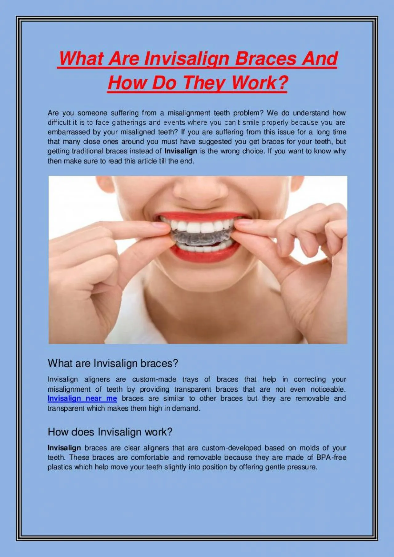 PDF-What Are Invisalign Braces And How Do They Work?