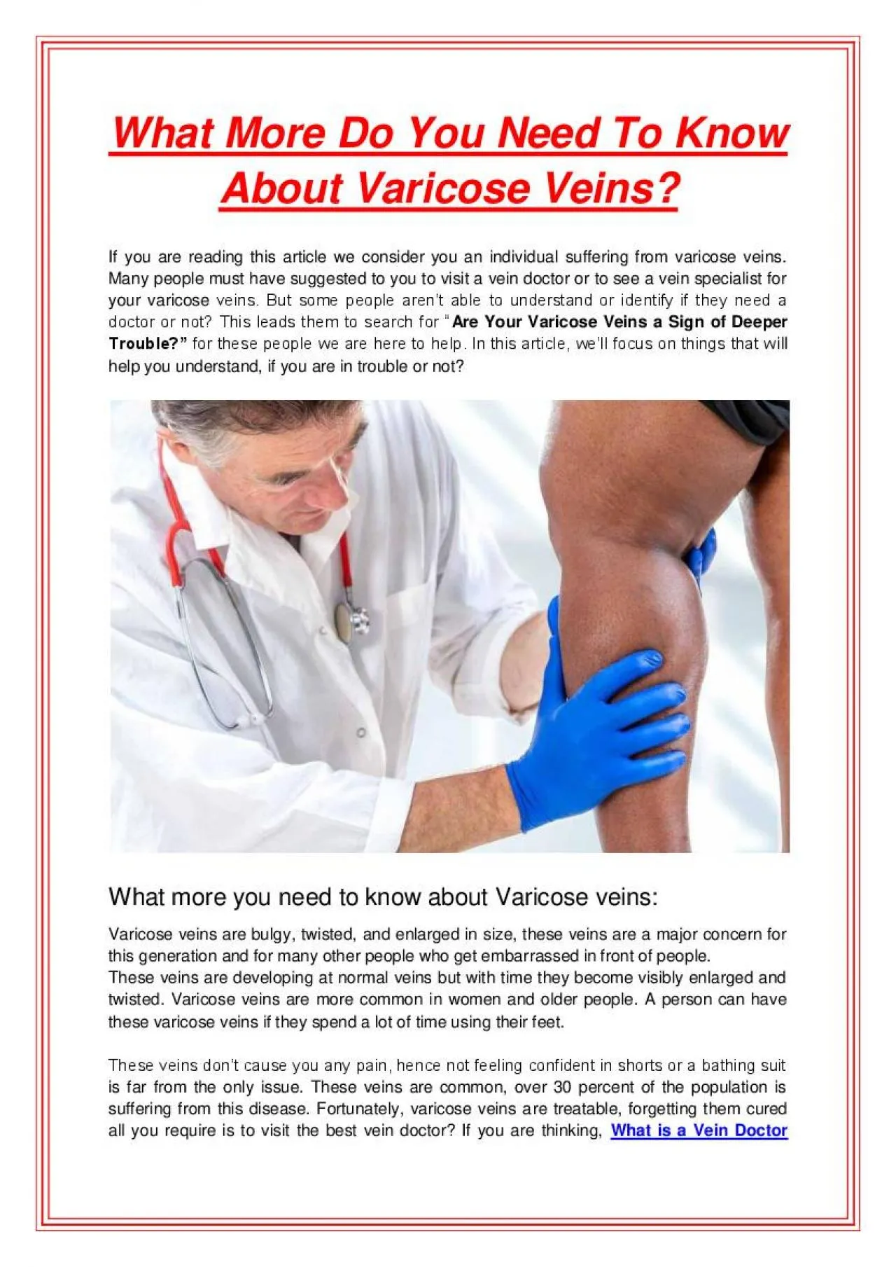 PDF-What More Do You Need To Know About Varicose Veins?