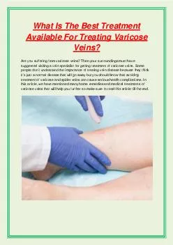 What Is The Best Treatment Available For Treating Varicose Veins?