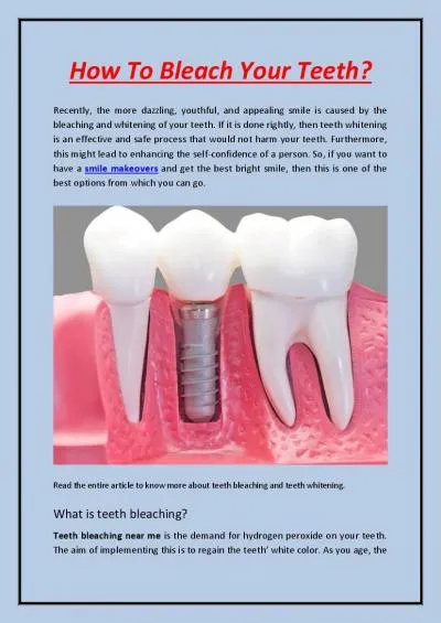 How To Bleach Your Teeth?