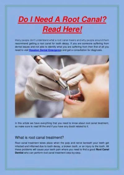 Do I Need A Root Canal? Read Here!