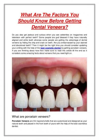 What Are The Factors You Should Know Before Getting Dental Veneers?