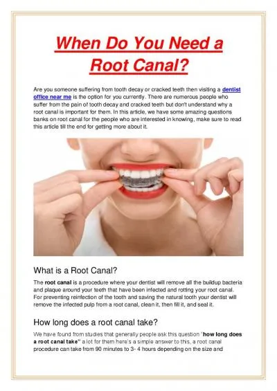 When Do You Need a Root Canal?