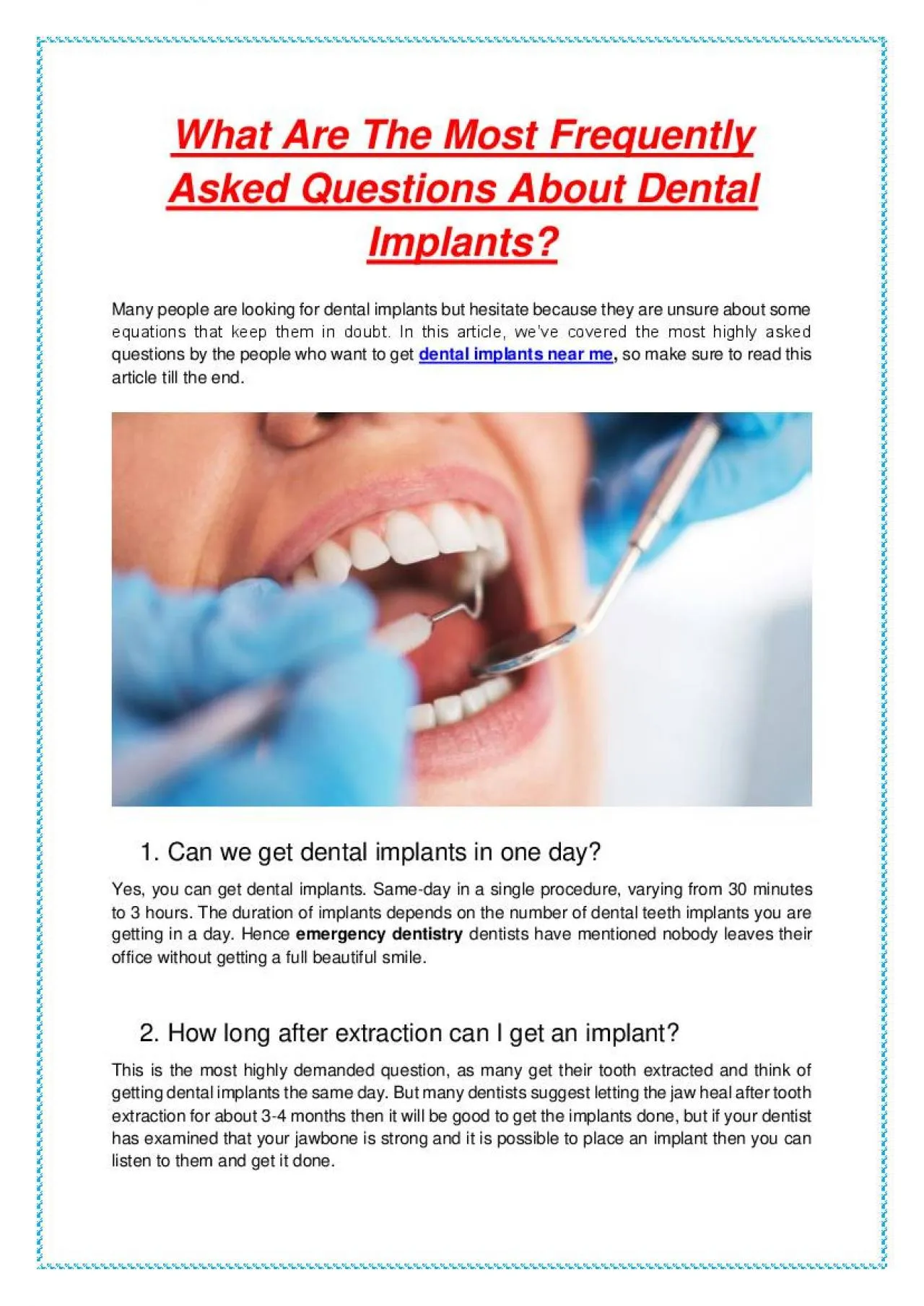 PDF-What Are The Most Frequently Asked Questions About Dental Implants?