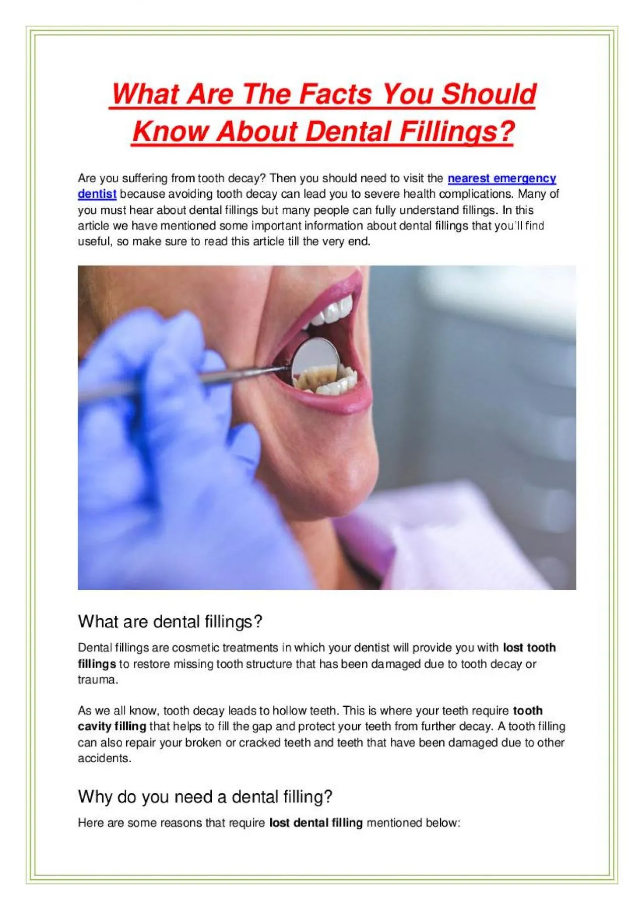 PDF-What Are The Facts You Should Know About Dental Fillings?