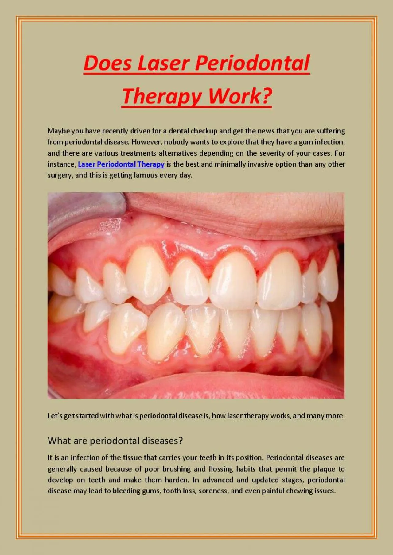 PDF-Does Laser Periodontal Therapy Work?