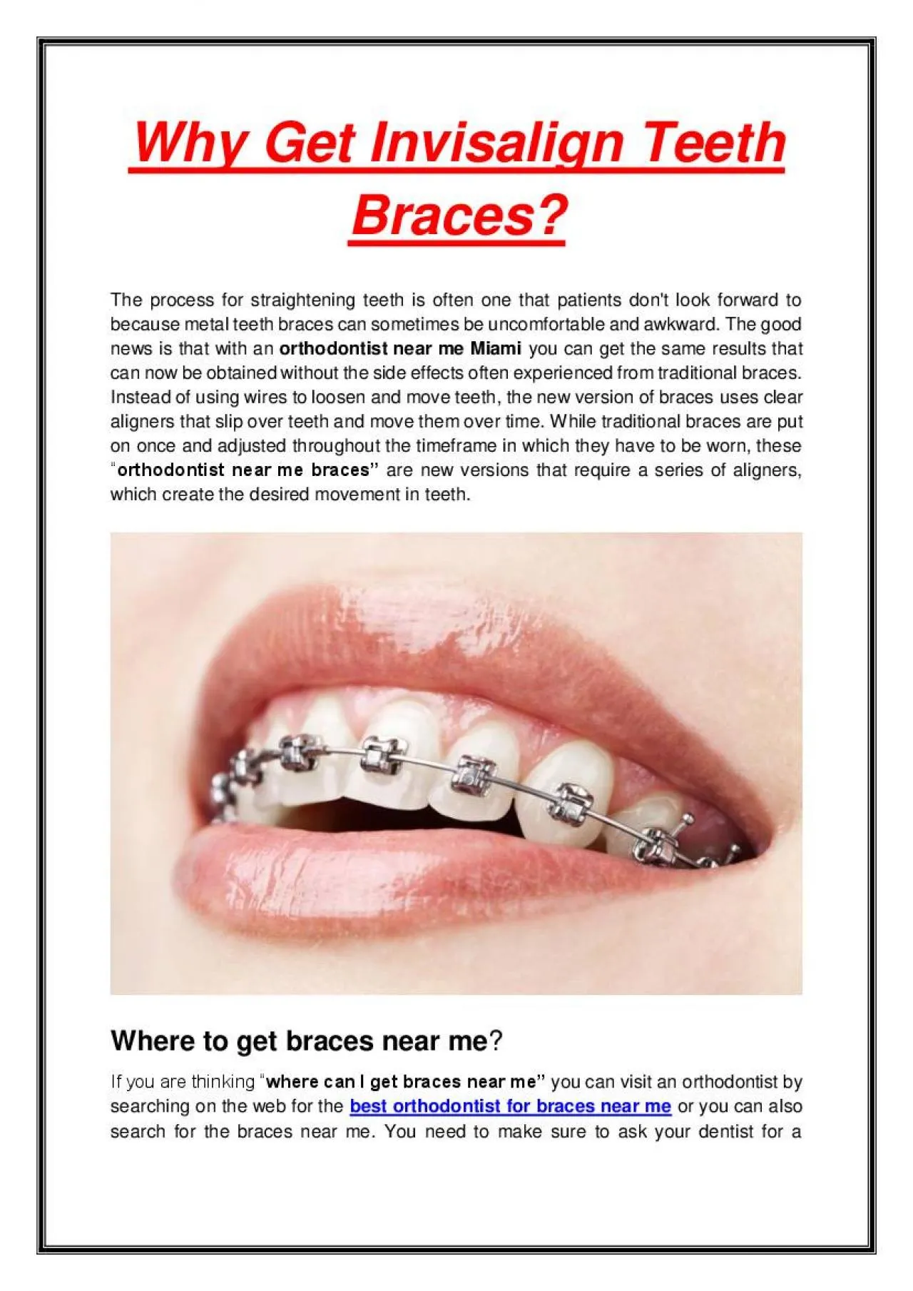 PDF-Why Get Invisalign Teeth Braces?