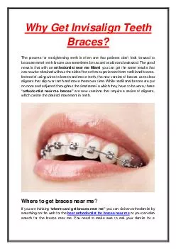 Why Get Invisalign Teeth Braces?