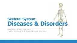 Skeletal System: Diseases & Disorders