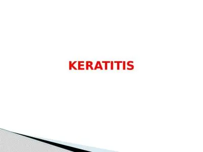 KERATITIS Inflammation of cornea characterized by moderate to intense pain and impaired