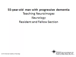 55-year-old man with progressive dementia