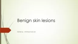 Benign skin  lesions Done by : Ahmad Al-Zu’bi