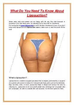 What Do You Need To Know About Liposuction?
