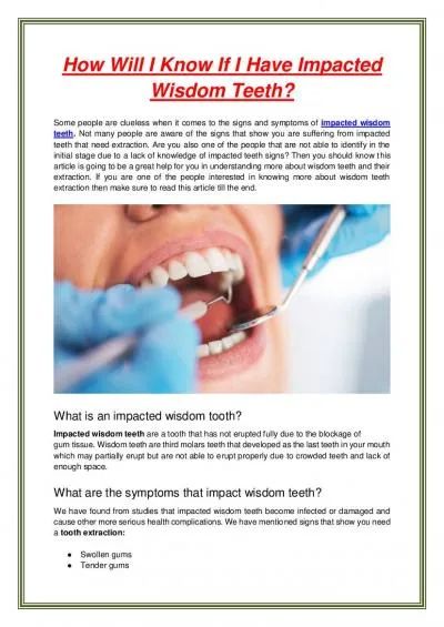 How Will I Know If I Have Impacted Wisdom Teeth?