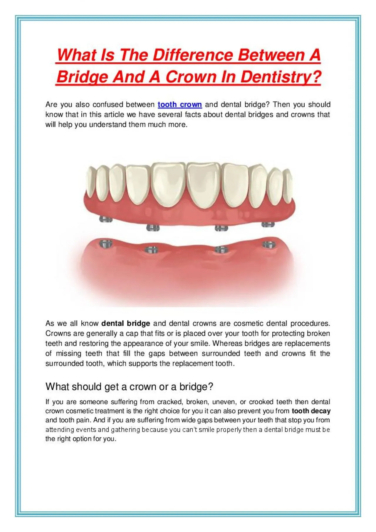 PDF-What Is The Difference Between A Bridge And A Crown In Dentistry?