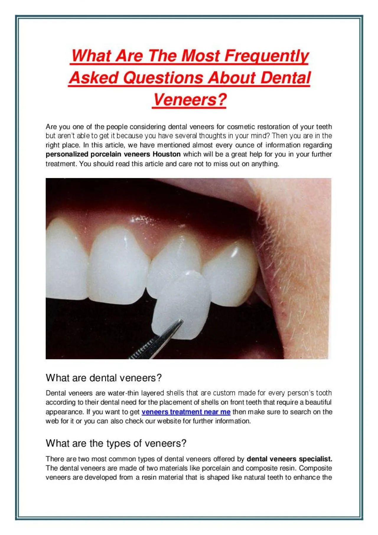 PDF-What Are The Most Frequently Asked Questions About Dental Veneers?