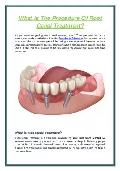 What Is The Procedure Of Root Canal Treatment?